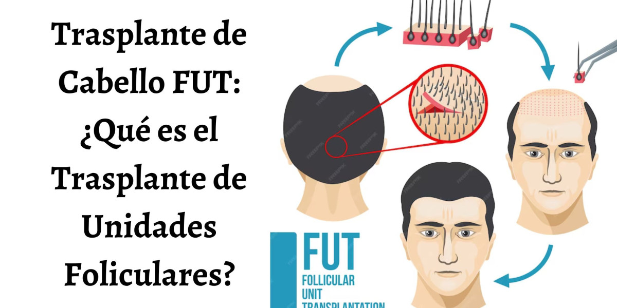 Trasplante de Cabello FUT: ¿Qué es el Trasplante de Unidades Foliculares?